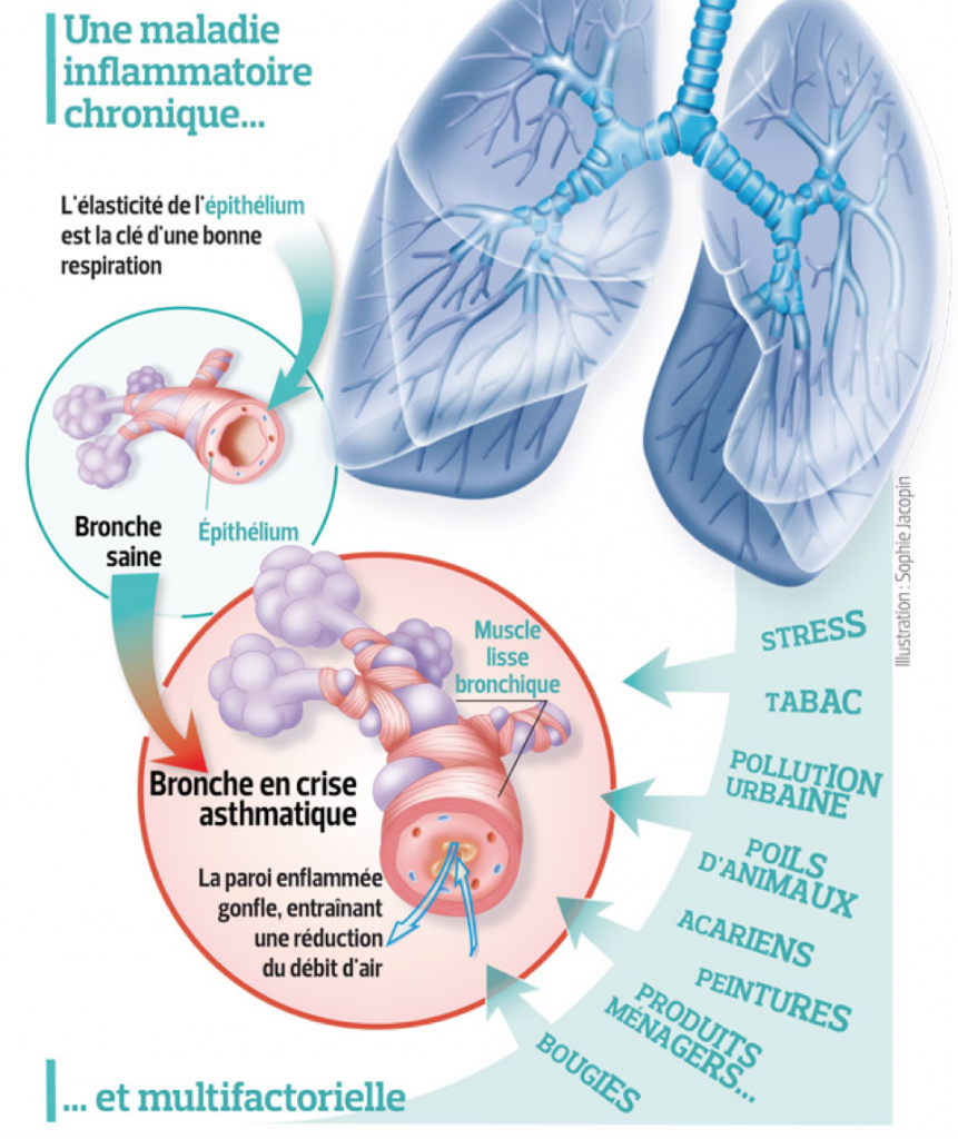 DOSSIERS SANTE Les infirmier(e)s de l
